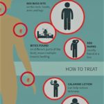 Bed bug bite infographic - Batzner Pest Control in Wisconsin