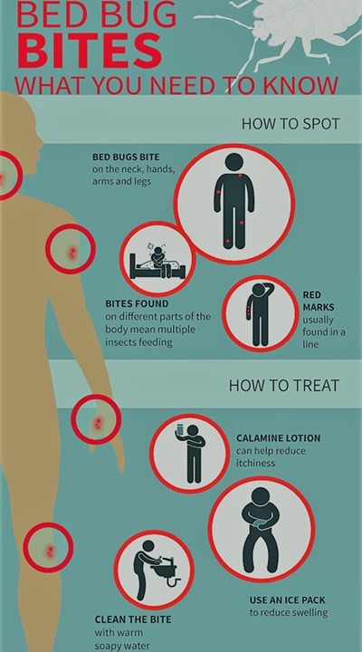 What Do Bed Bug Bites Look Like Information On Symptoms Treatment