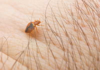 Do bed bugs bite? | New Berlin WI | Batzner Pest Control